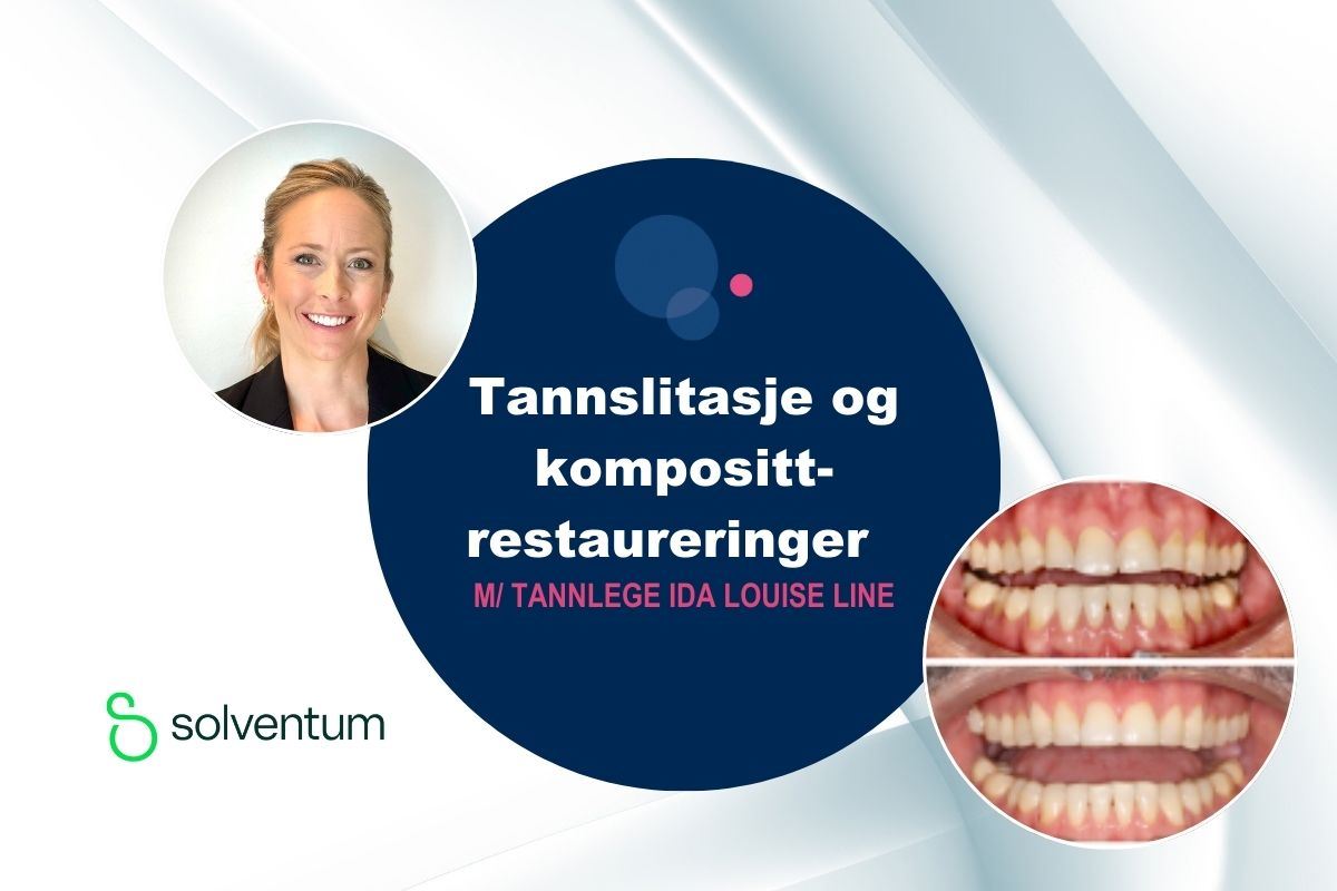 Tannslitasje og komposittrestaureringer