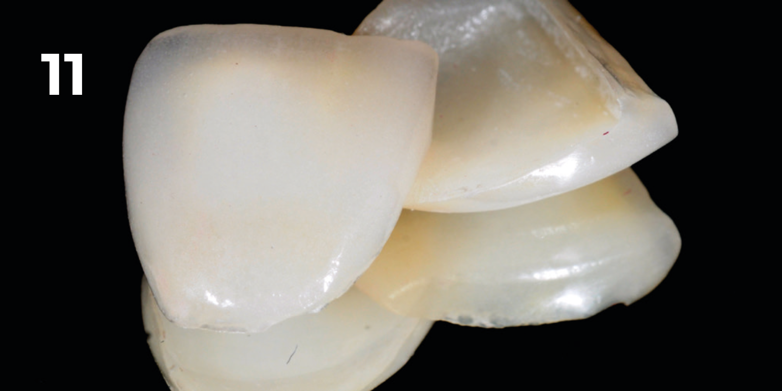 kuraray - panavia v5 - 11.png