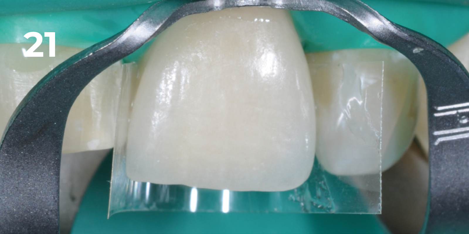 kuraray - panavia v5 - 21.png