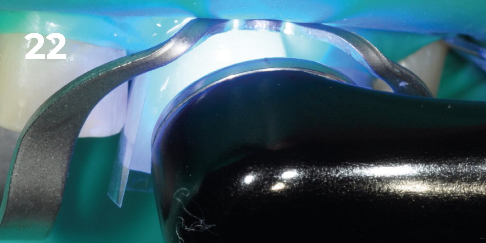 kuraray - panavia v5 - 22.png