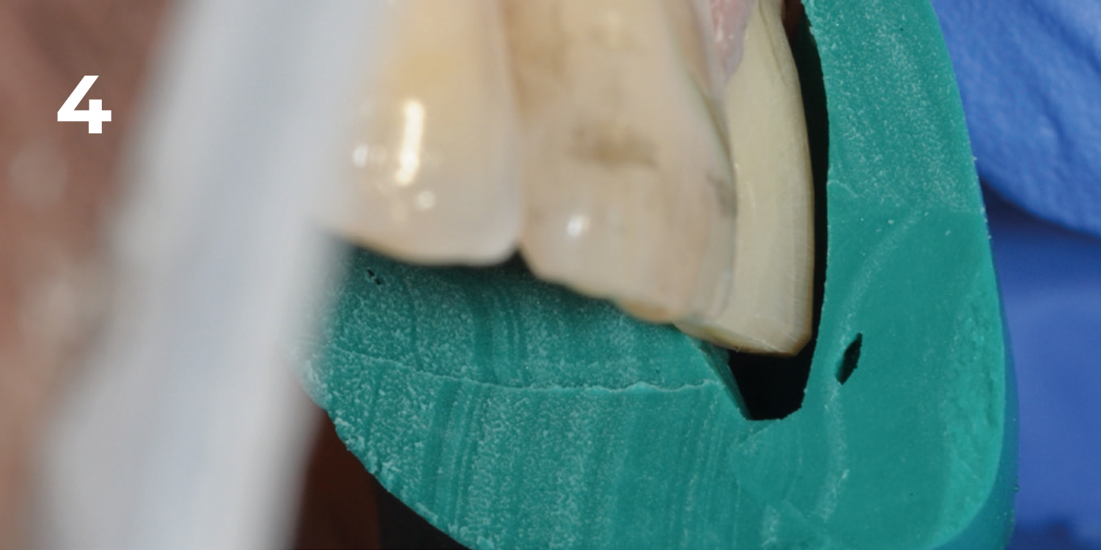 kuraray - panavia v5 - 4.png