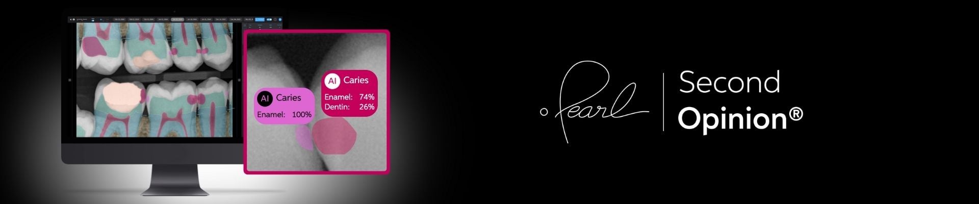 Pearl freemium skjema.jpg